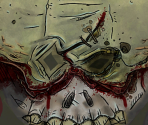 Undead Ned - Borderlands