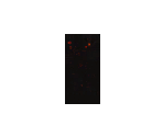 Burned Corpse - Bloodborne
